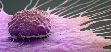 研究人员发现乳腺癌细胞如何产生治疗耐药性