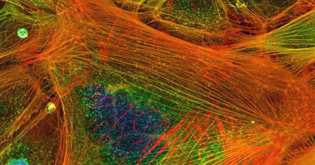 生物物理学家揭示了三种蛋白质如何相互作用来微调细胞运动