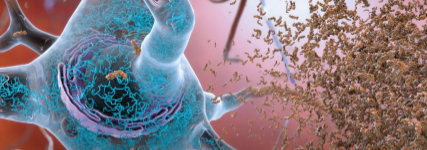 针对截短的淀粉样β蛋白开发出针对阿尔茨海默病的新型疫苗和治疗方法